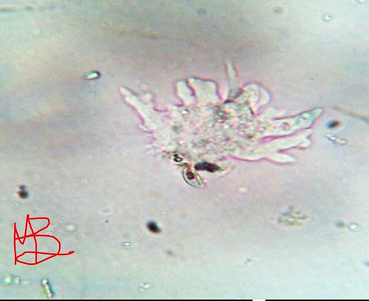 Amoeba stellata metamorfosi